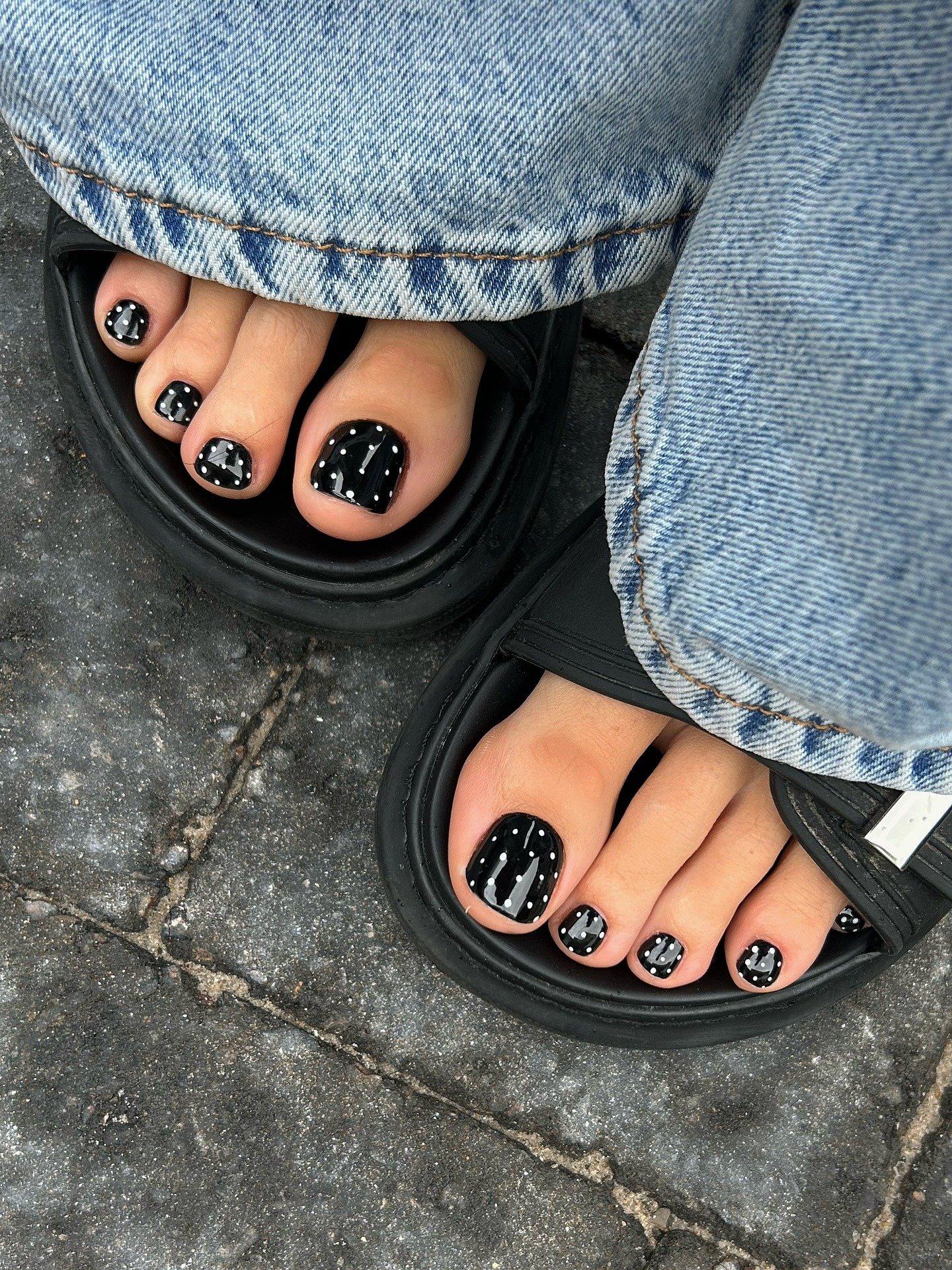 unhas quadradas pé