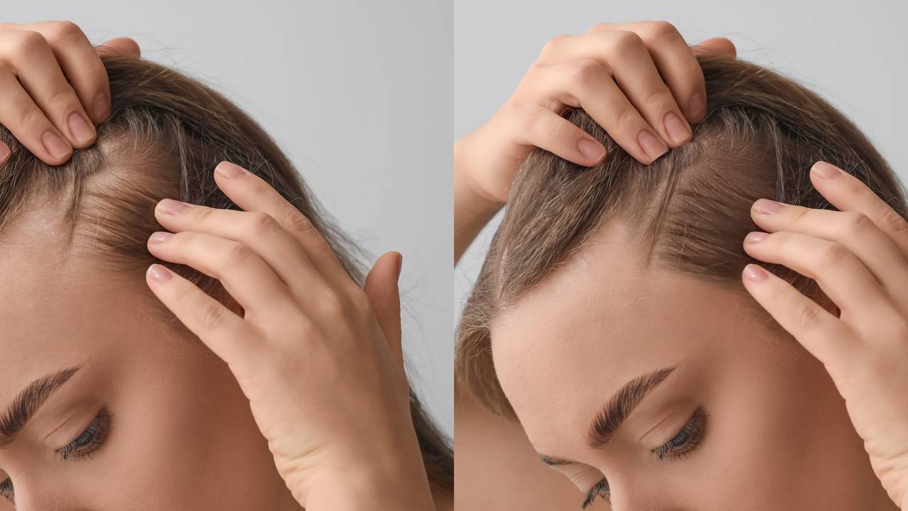 shampoo seco salva cabelo