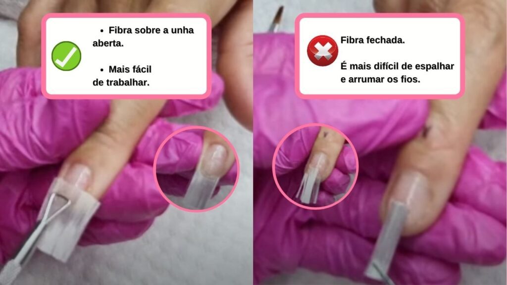 micose unha de gel
