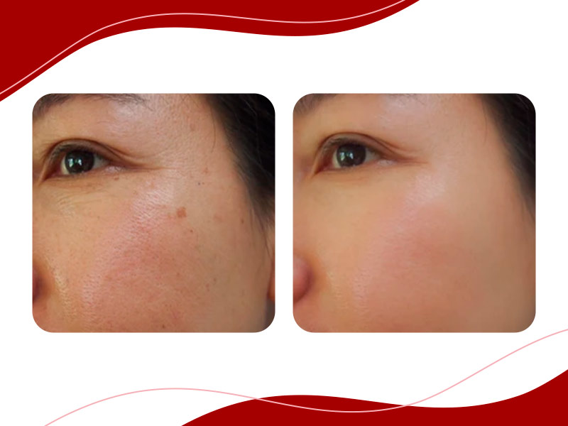 retinol puro para que serve