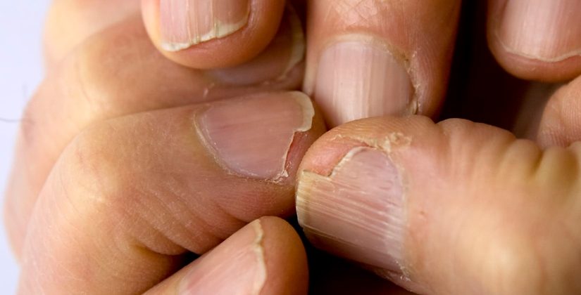 como usar esmalte craquelador